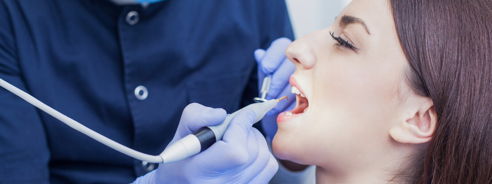 Professional Teeth Cleaning in Glendale CA area